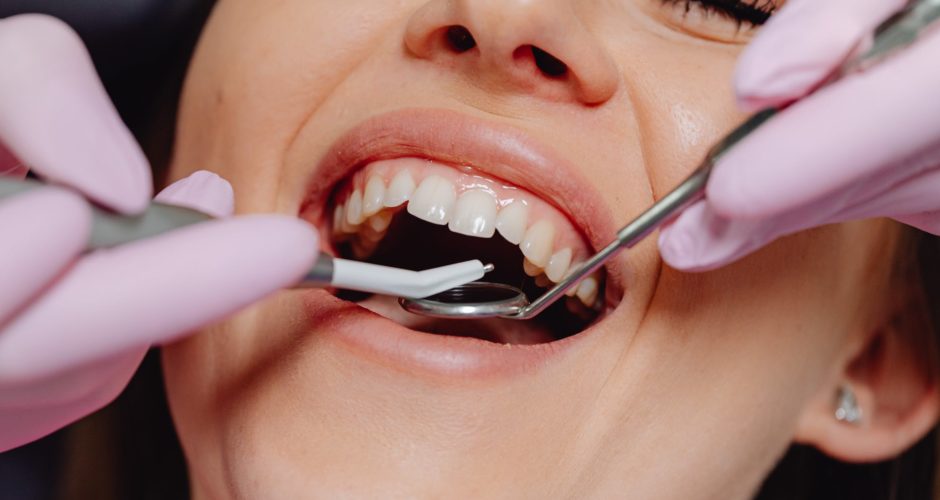 Flap surgery in Lucknow - Gum disease treatment